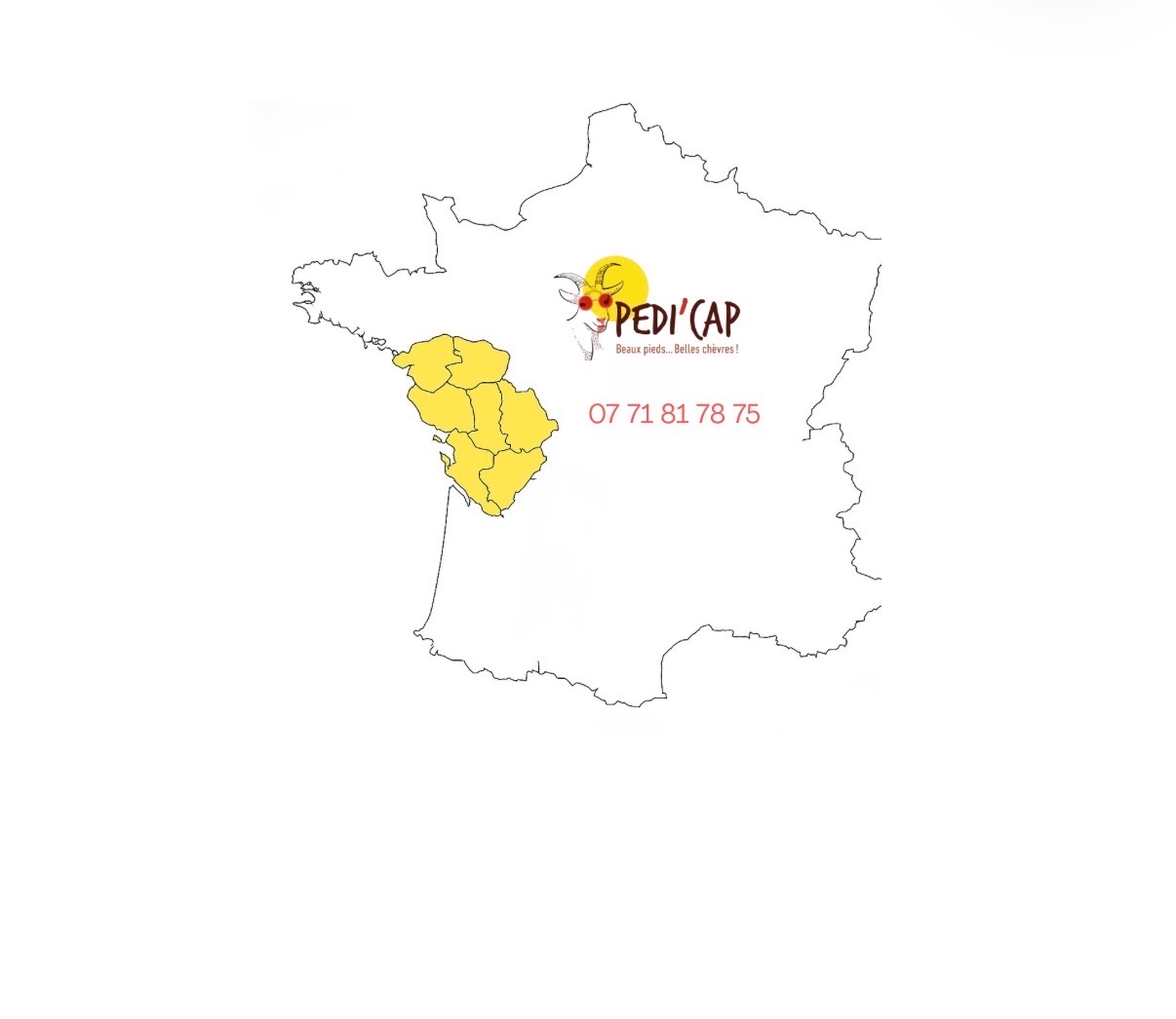 Zone d'intervention Pedi'cap - Vendée et Pays de la Loire